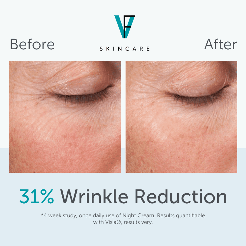 Factor Five Night Retinol Cream